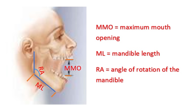 MMO, ML, and RA