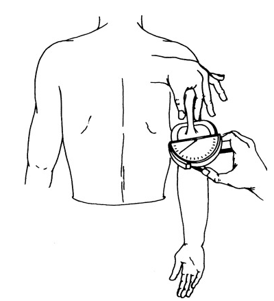 Figure 1. Measurement of triceps skinfold using a Lange caliper. With the subject's arm in a relaxed position, the skinfold is picked with thumb and index fingers at the midpoint of the arm.